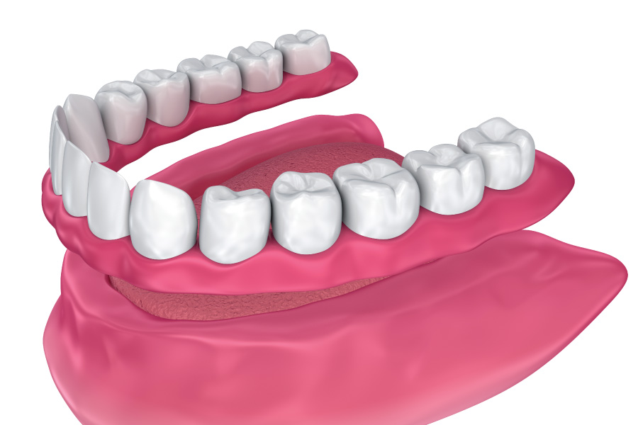 Arlington IMmediate Dentures