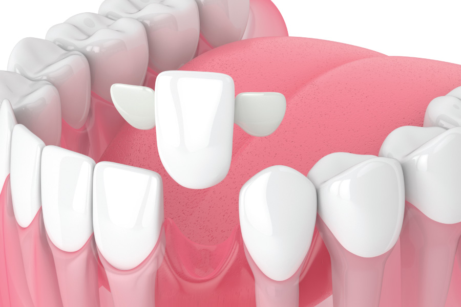 Arlington Maryland Bridges